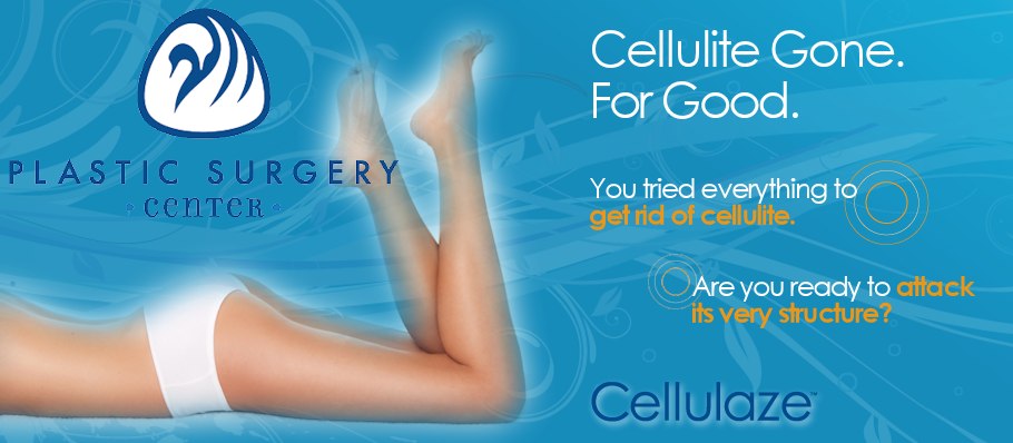 Cellulaze Cellulite Treatment